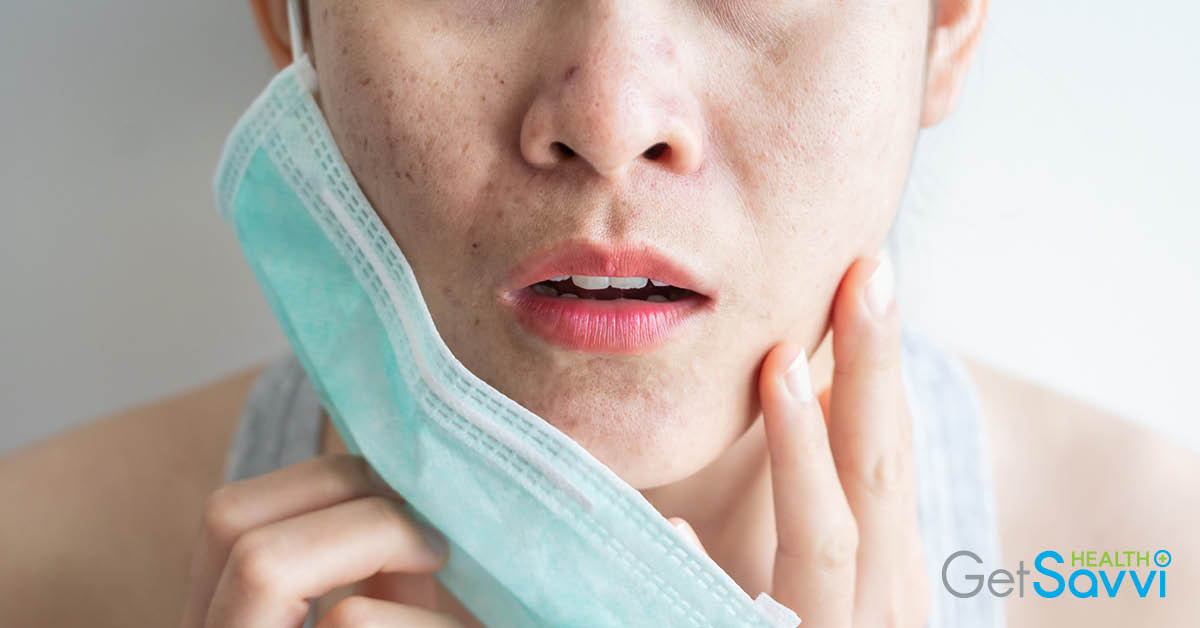 What Is Maskne And How To Avoid It 